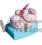 The dissection model of brain and cerebral arteries